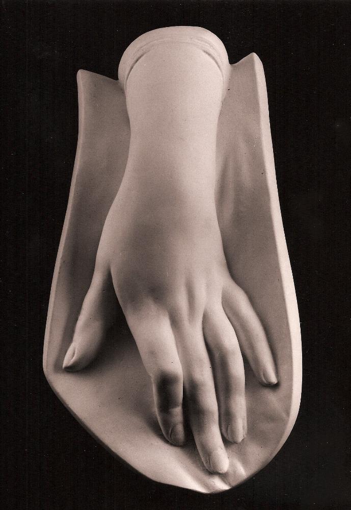 Photo of a plaster cast of a female hand