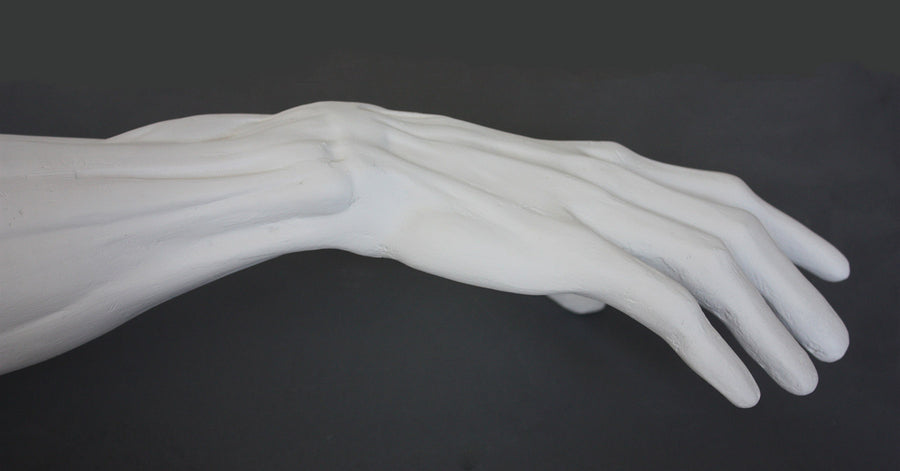 Photo of plaster cast sculpture of flayed arm with a gray background 